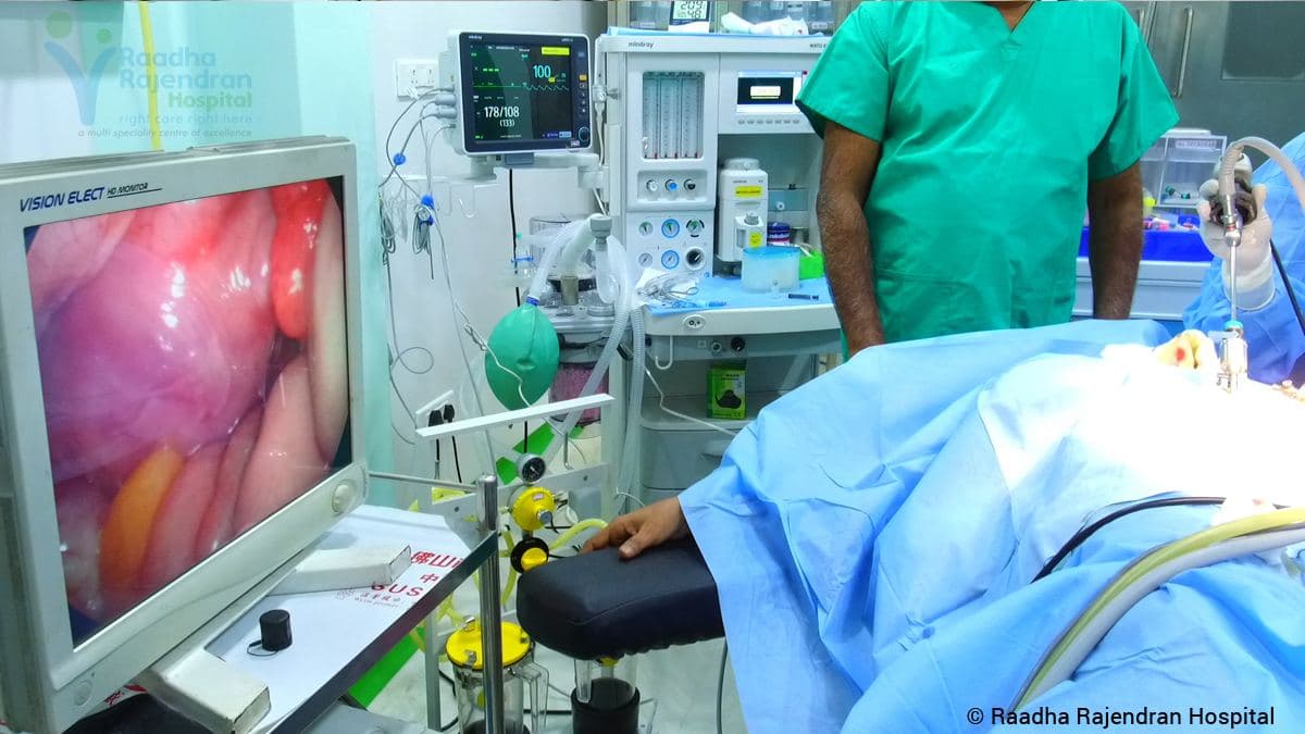 Laparoscopic Surgery